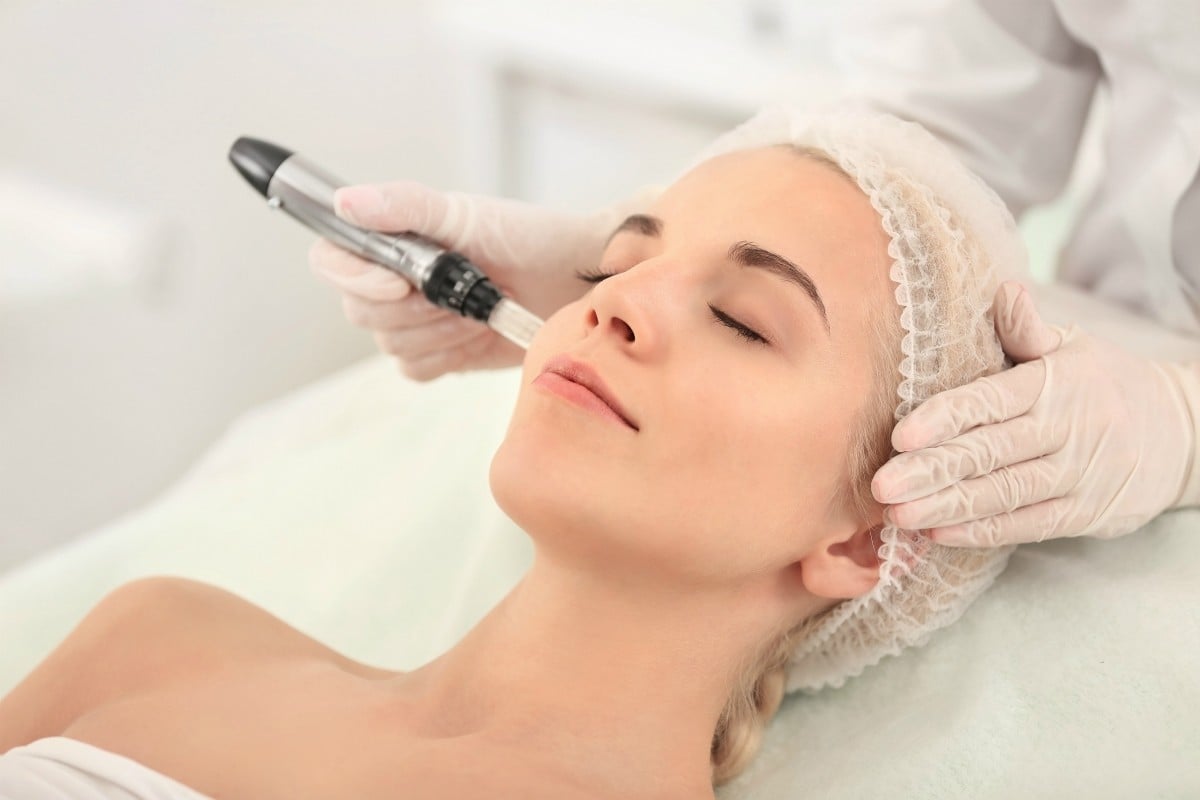 Micro needling